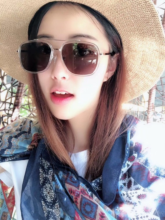 玲子最美埋线双眼皮第243天美丽日记-新氧美容