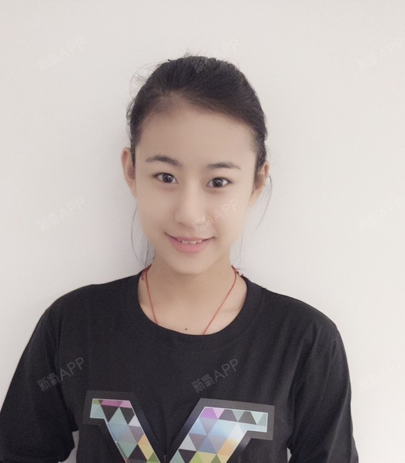 清酒桃花eag鼻部修复第76天美丽日记-新氧美