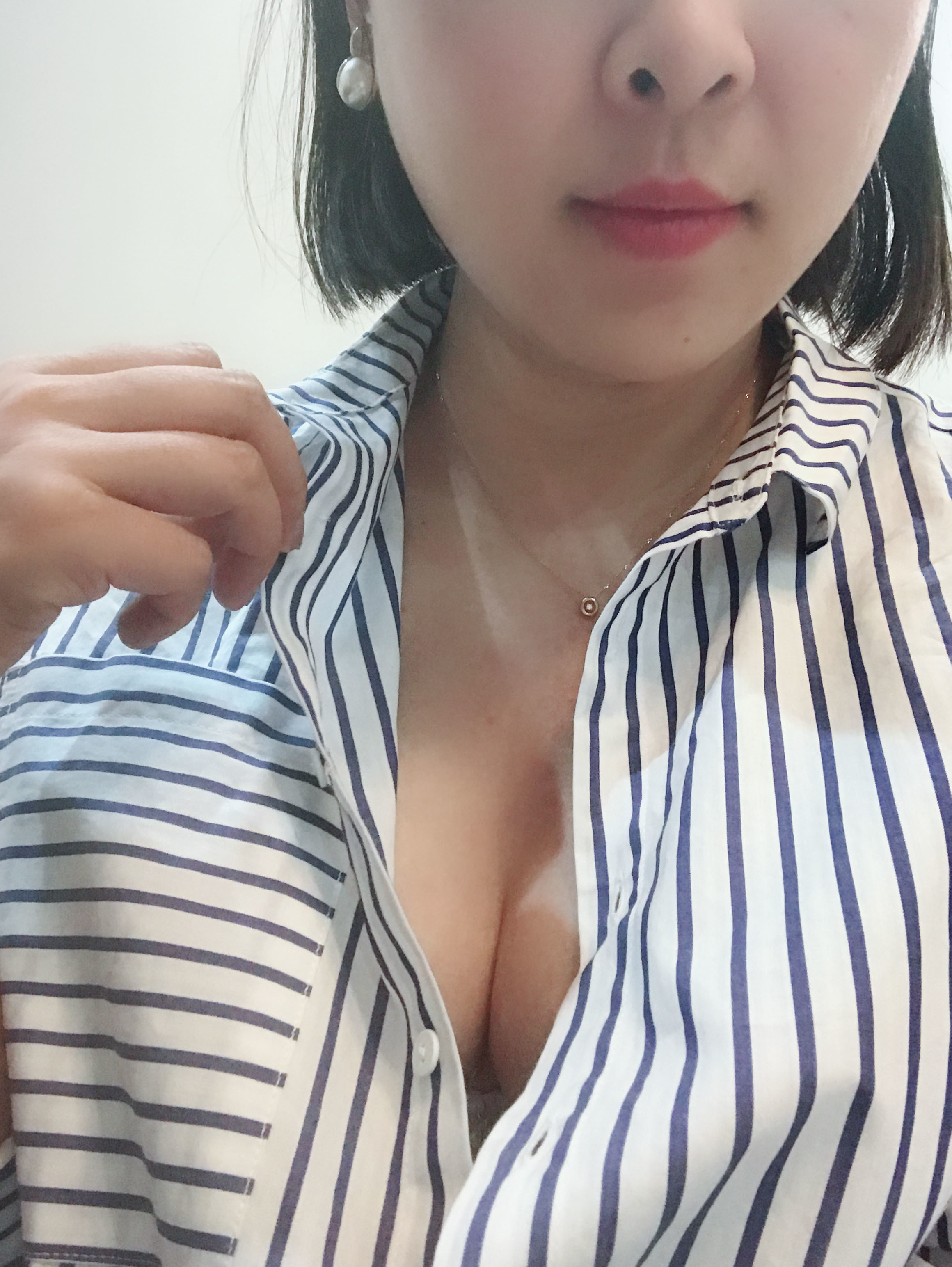 深圳恩吉娜医疗美容门诊部自体脂肪隆胸怎么样_恢复