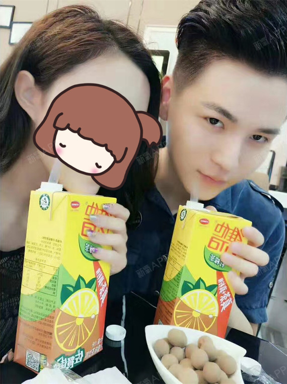 啾啾小王子鼻综合第580天美丽日记-新氧美容整