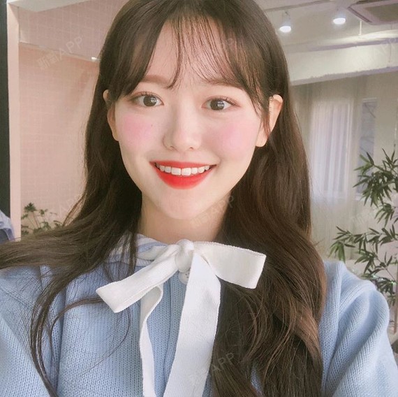 好的人定点双眼皮第46天美丽日记-新氧美容整