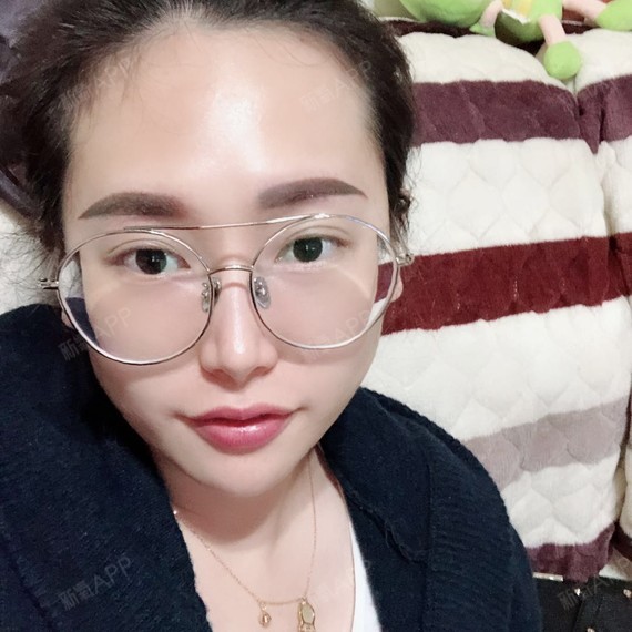 故禾切开双眼皮第223天美丽日记-新氧美容整形