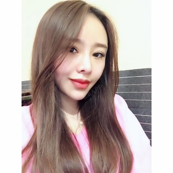 azha自体脂肪全脸填充第15天美丽日记-新氧美