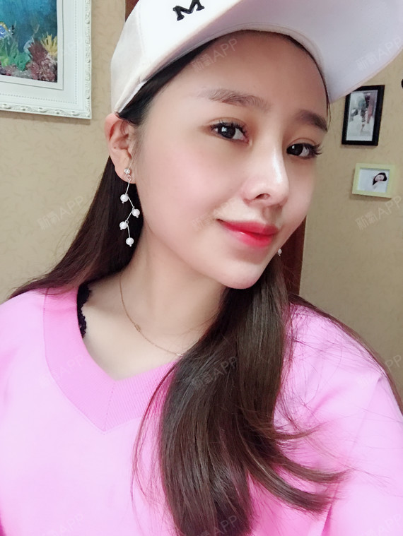 azha自体脂肪全脸填充第15天美丽日记-新氧美