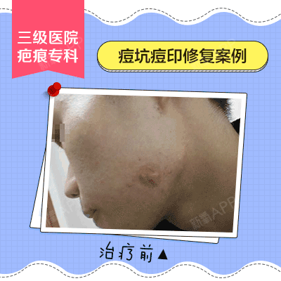 400_400 gif 动态图 动图