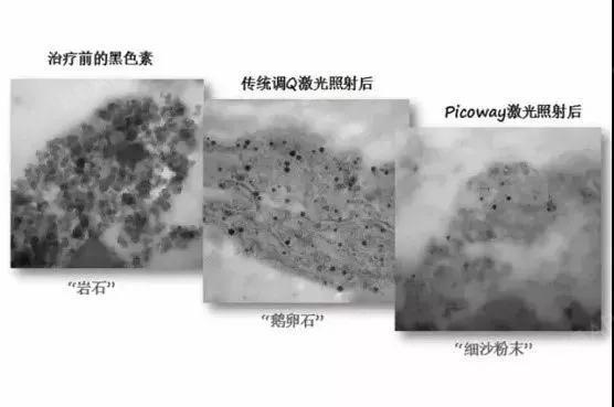 要要切克闹,祛斑也有Freestyle~亚洲人的美貌容