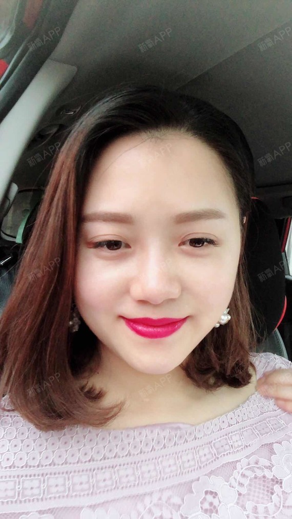 佩奇猪猪0皮秒激光第19天美丽日记-新氧美容整