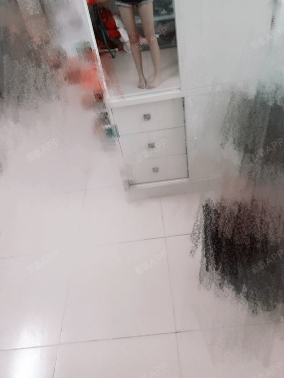 氧气0541601514436975吸脂瘦小腿第23天美