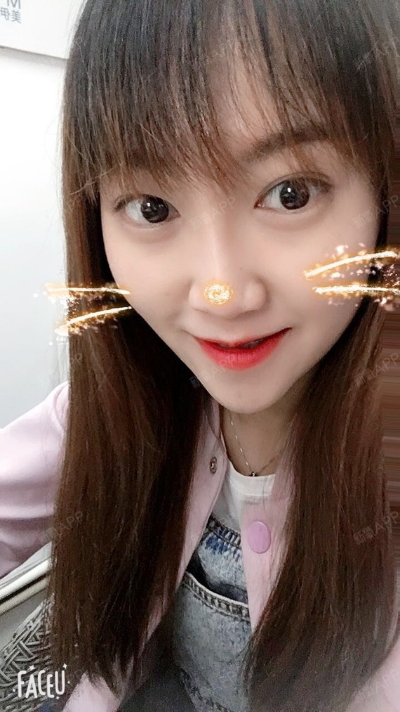 做我枕边人绒玻尿酸隆鼻第17天美丽日记-新氧