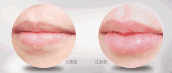 我的嘴唇看起来算是正常的状态,但是上唇灰常薄,涂