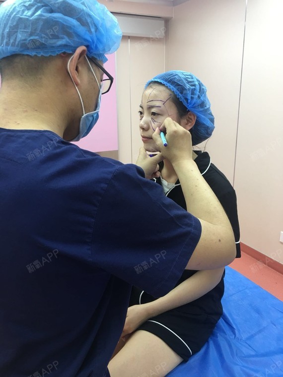 自体9017941521444796氧气脂肪全脸填充第0初三内向的毕业后女生打工图片