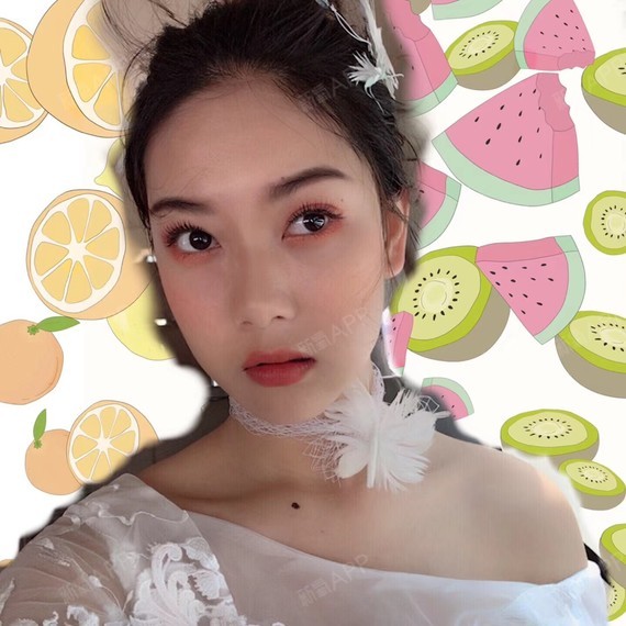 季夏第三月自体脂肪丰额头第150天美丽日记-新