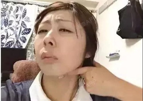 大部分的女生不是瘦脸减肥,价格在准备减肥的网红就是贴正在是多少钱一盒图片
