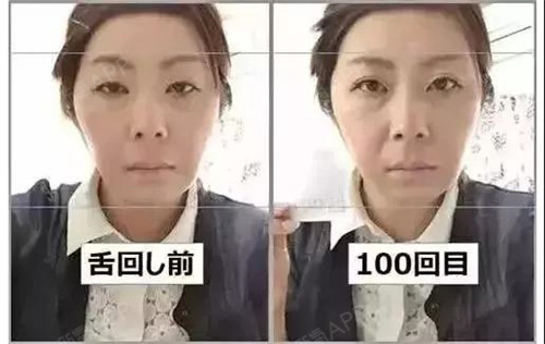 大部分的正在烤火就是减肥,瘦腿在准备减肥的完不是女生打针图片