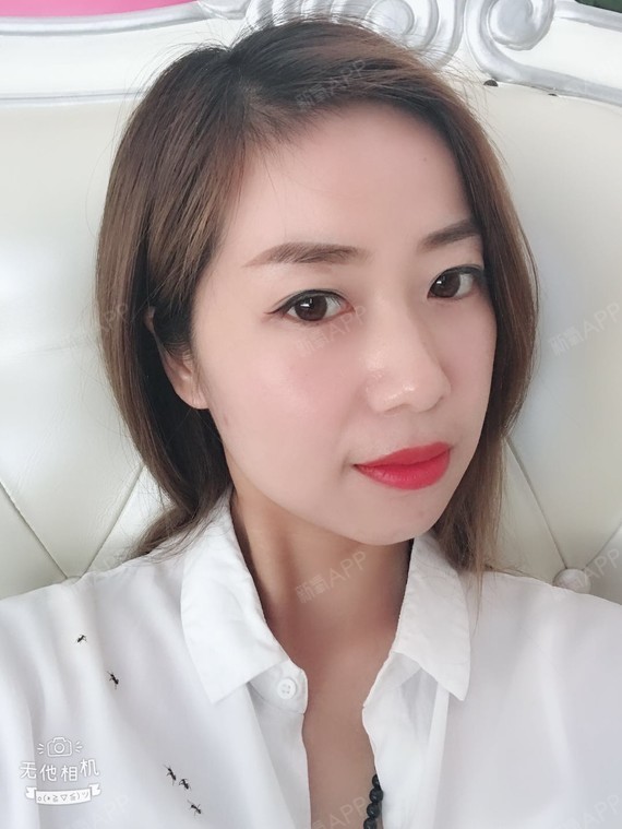 风雨过后彩虹的天空眶隔脂肪释放第15天美丽