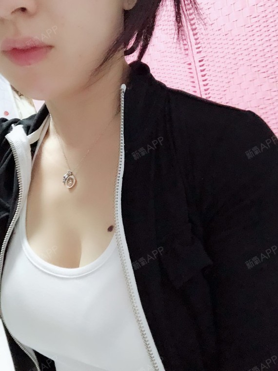 假体隆胸