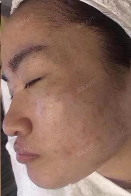 氧气7510591526608968点阵激光第21天美丽