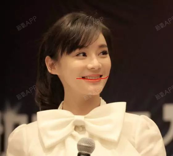 牙齿与微笑美学的关系,牙齿矫正堪比整容