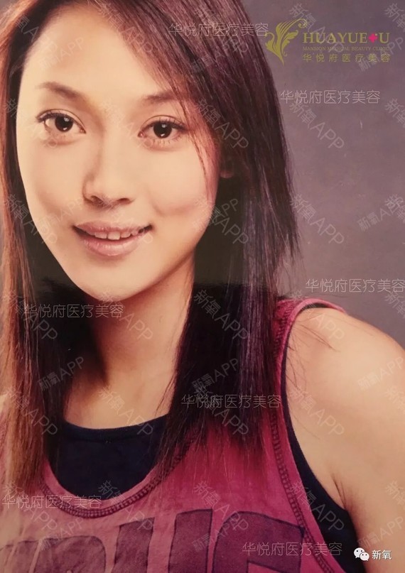 一个是花400万整形成瘾的美女,一年必来一台大