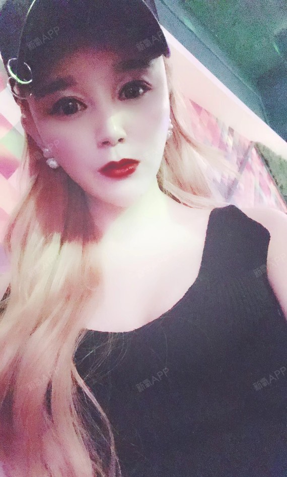 ioo自体脂肪全脸填充第13天美丽日记-新氧美容