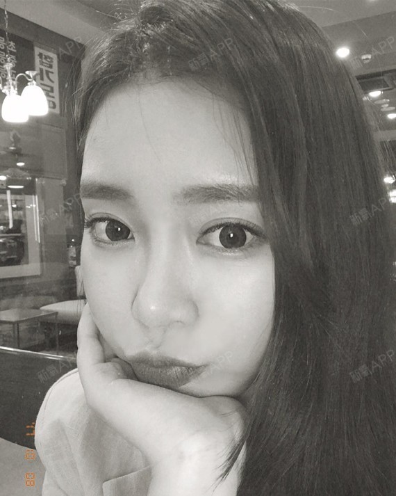 这无奈的人生激光去眼袋第12天美丽日记-新氧