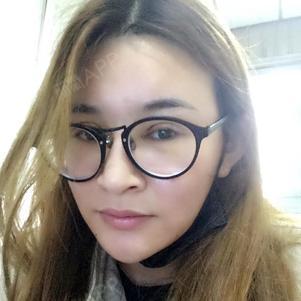 宁宁姐姐开内眼角第0天美丽日记-新氧美容整形