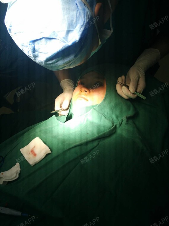 氧气8415233491448827切开双眼皮第7天美丽