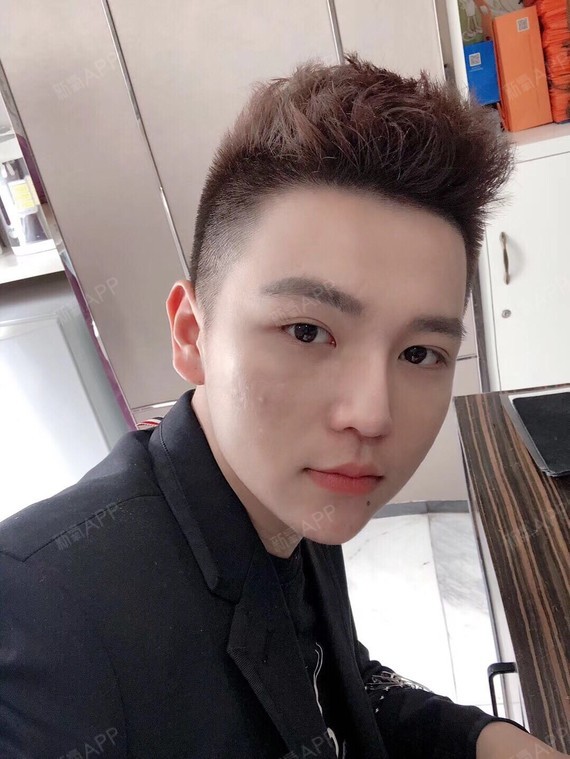 啾啾小王子鼻综合第605天美丽日记-新氧美容整