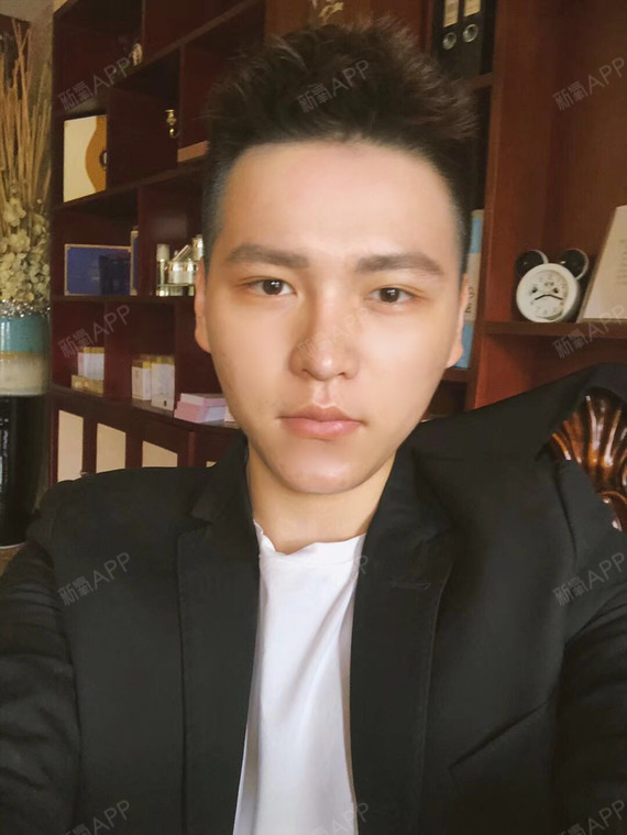 啾啾小王子鼻综合第605天美丽日记-新氧美容整