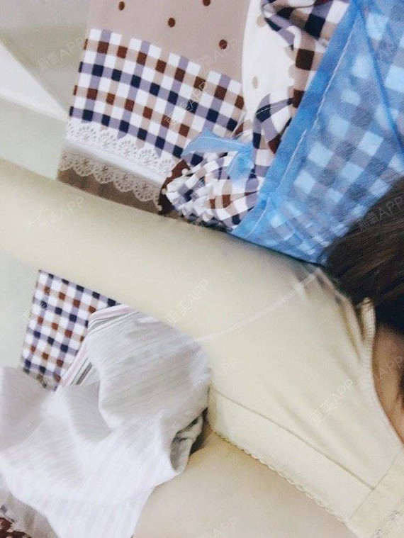 我要得变美美哒吸脂瘦小腿第2天美丽日记-新氧