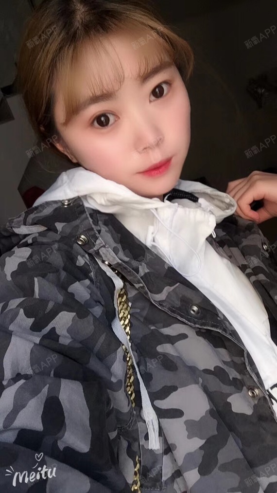 阿小阿啊膨体垫下巴第7天美丽日记-新氧美容整