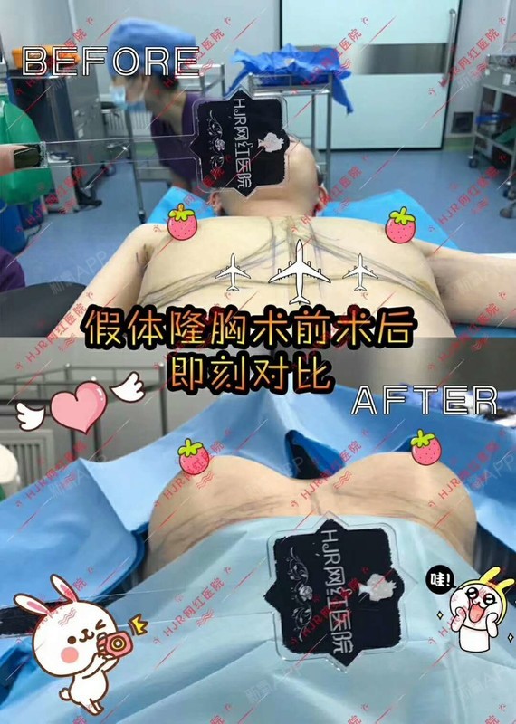 e胸 有多大图片