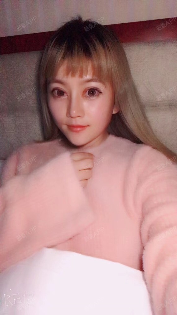 你是我手心的奶茶硅胶隆鼻第29天美丽日记-新