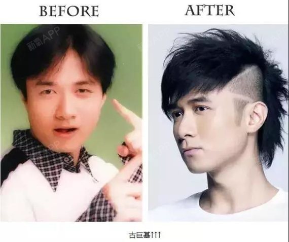 看着就很心动 看看明星们双眼皮前后对比变化 很多妹子对双眼皮手术