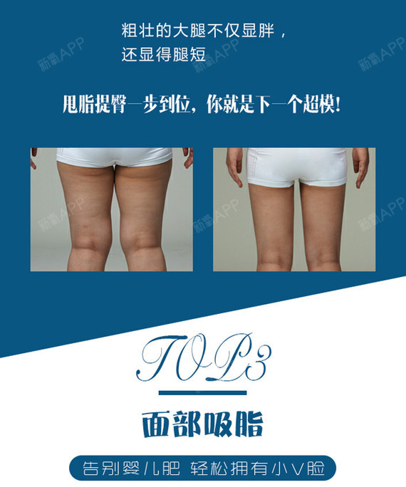 【吸脂】立体分层吸脂,想瘦哪里就瘦哪里,价格低至2999元