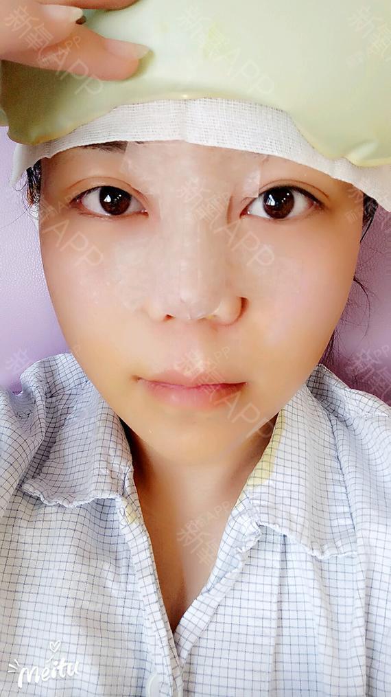 氧气7374311527860249鼻综合第0天美丽日记