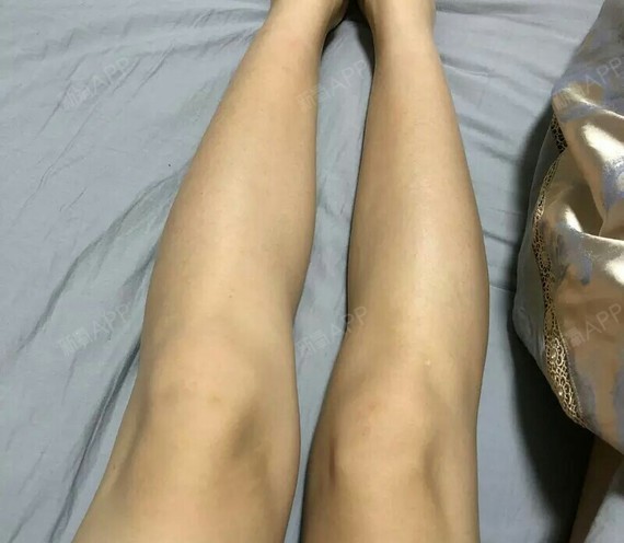 晚上睡觉时左小腿酸胀是怎么回事啊?