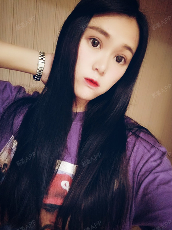 柠檬不萌3眼部综合第103天美丽日记-新氧美容