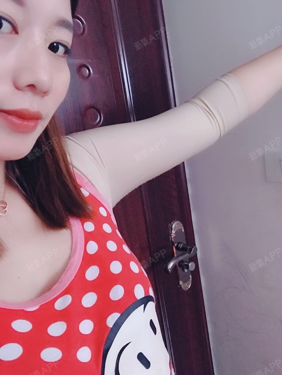新氧- 呐呐呐娜娜 | 胸部 | 美体塑形 | 去副乳 | 吸脂去副乳 | 吸脂