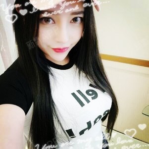 爱你一点点吸脂瘦手臂第132天美丽日记-新氧美