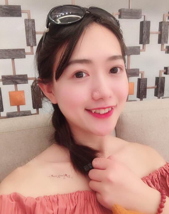 三种风格的双眼皮,看看你适合哪一种?