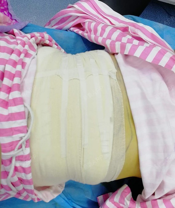 氧气6591171512054514扇贝瘦吸脂第0天美丽腹部怎么洗内脏图片