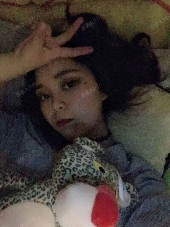 回到瘦脸1肉毒素原点第60天美丽日记-新氧美容塑身机有什么好处图片