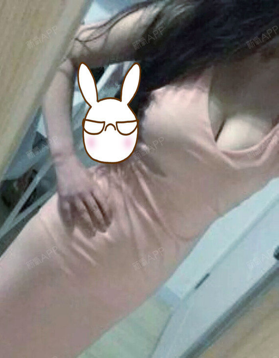 颜值即正义假体隆胸第33天美丽日记-新氧美容