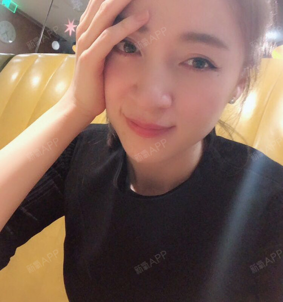 佛西少女水光针第9天美丽日记-新氧美容整形