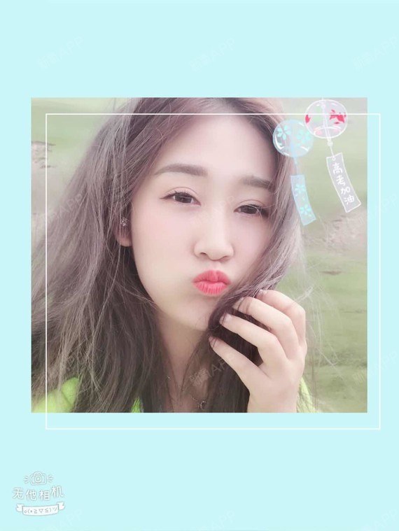 含蓄小女人自体脂肪丰额头第53天美丽日记-新