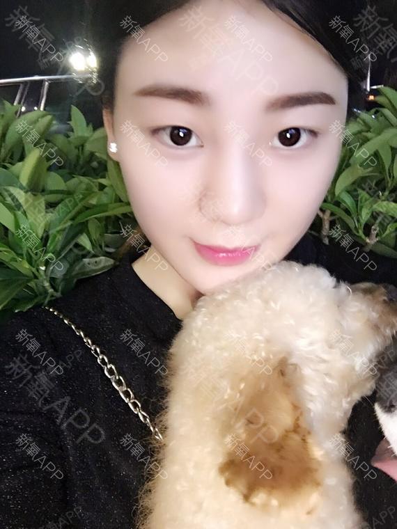 氧气1429301523597353玻尿酸丰苹果肌第39