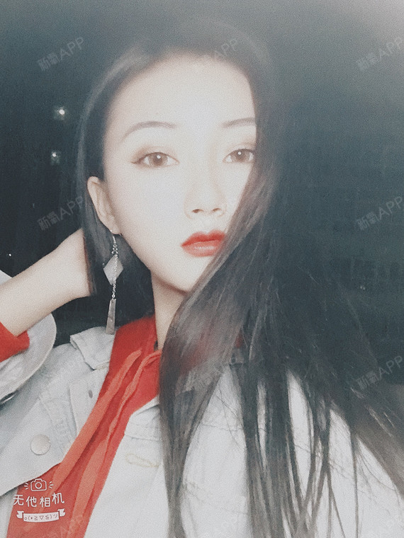 佛系少女A切开双眼皮第42天美丽日记-新氧美