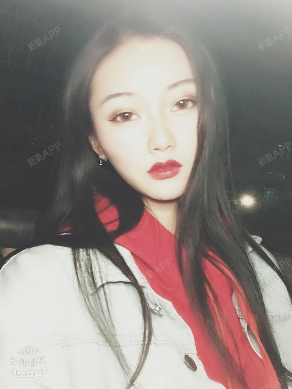 佛系少女A切开双眼皮第42天美丽日记-新氧美