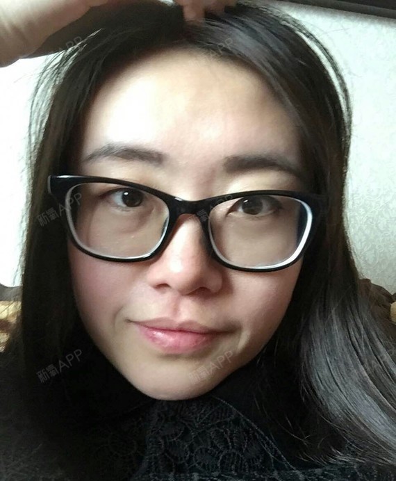 氧气6621821529904134提升埋线第1天美肥牛丽日zhan图片